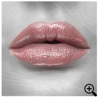 faltenunterspritzung, lippenvergrößerung, lippenaufbau, Lipolyse, hyaluronsäure