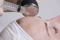gesichtsbehandlung gesichtsreinigung gesicht behandlung reinigung lörrach basel steinen kosmetikstudio kosmetikerin kosmetik acne